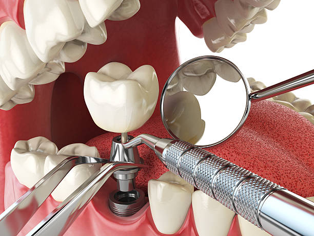 Best Emergency Broken Tooth Repair in Emporium, PA